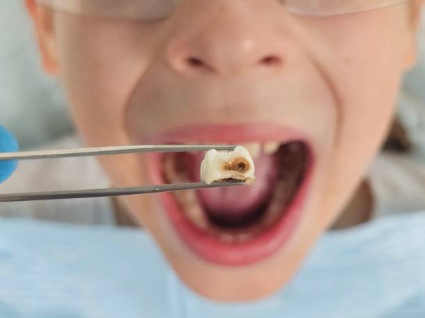 Best Urgent Dental Care  in Brooksi, DE